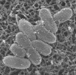 　百日ぜき菌の電子顕微鏡画像（国立健康危機管理研究機構提供）