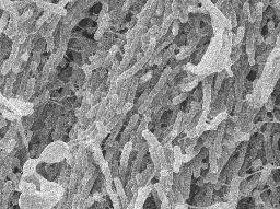 　走査型電子顕微鏡で捉えた結核菌（結核予防会結核研究所提供）