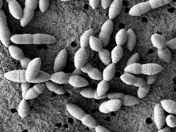 　腸内細菌「ＹＢ３２８」の電子顕微鏡画像（産業技術総合研究所、国立がん研究センター提供）