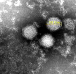 　「重症熱性血小板減少症候群」を引き起こすウイルスの電子顕微鏡写真（国立健康危機管理研究機構提供）