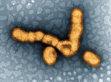 　インフルエンザウイルスの電子顕微鏡写真（米国立アレルギー感染症研究所提供）